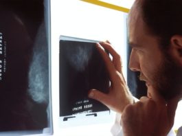 L’intelligence artificielle va-t-elle bouleverser la profession médicale ?